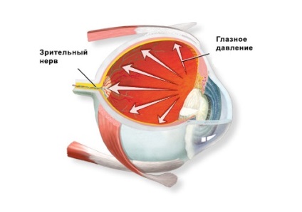 Știri - centrul de ochi microchirurgie elvisus