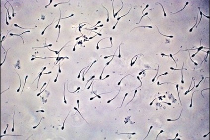 Petesejt megtermékenyítése spermával, valamint, hogy mennyi idő van egyesítés