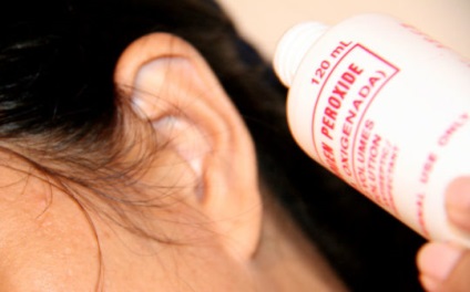 Водороден пероксид в ухото може да капе дали и как