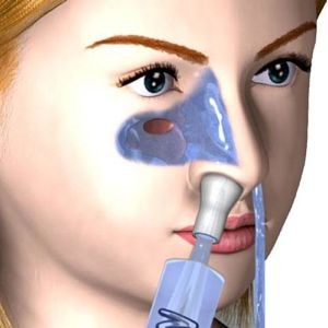 Clătirea nasului cu sinuzită cum să curățați sinusurile maxilare din puroi