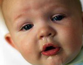 Megfázás csecsemők tünetek, kezelés, megelőzés, ru-babyhealth