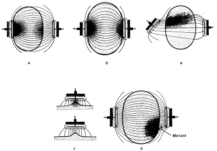 Összefoglalás UHF-terápia