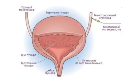 Ejaculare retrogradă cu prostată