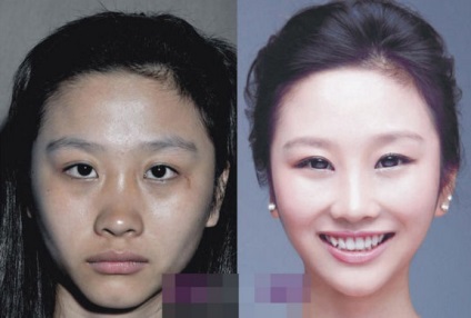 Șocul unei femei chinezești înainte și după operația plastică