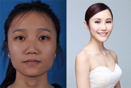 Standardele de frumusețe ale unei femei chineze după plastic