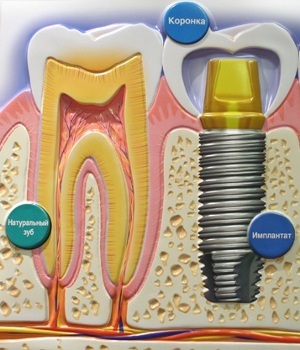 Dental clinic - denta - instituții medicale