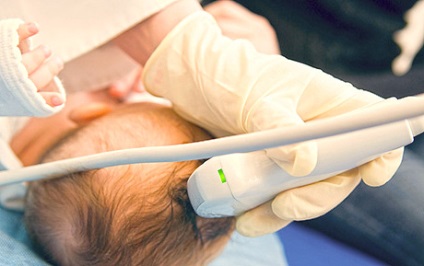 agyi ultrahang csecsemőknél és újszülött gyermek norma, dekódolás