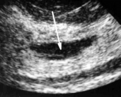 Sânge ultrasunete atunci când este mai bine să faceți, în ce zi a ciclului, care arată decodificarea și norma