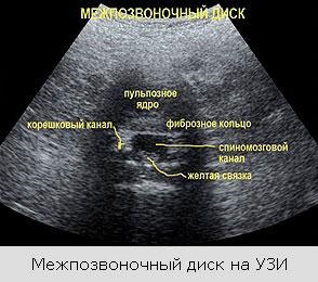 Uzi de coloana vertebrală a coloanei vertebrale cervicale și lombare, prețurile pentru diagnosticare - viața mea