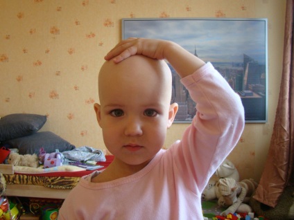 Veleszületett alopecia tünetek, diagnózis és kezelés