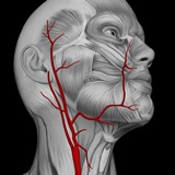 Ateroscleroza vaselor urechilor - grade, simptome, tratament