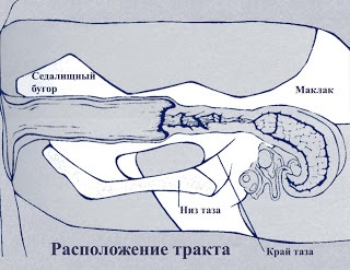 Inseminarea artificială