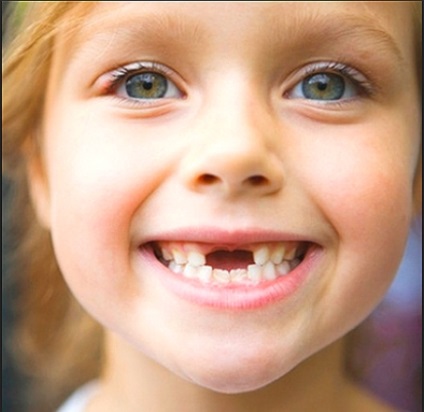 Cum să distingem dinții molari de molari