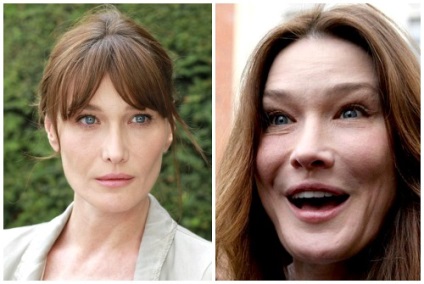 Carla Bruni előtt és után műanyag, fotó és videó modellek