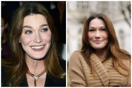 Carla Bruni înainte și după modelele din plastic, foto și video