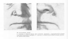 Clinica de tumori maligne epiteliale, ghid de medic