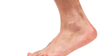 hygroma lábápolás népi és sebészeti módszerek