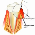 Tratamentul durerilor post-pilling