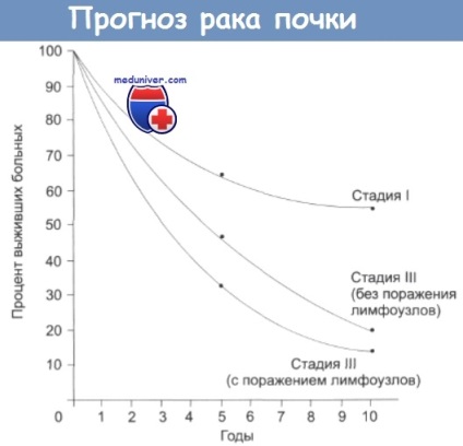 Tratamentul cancerului de rinichi și prognoza acestuia