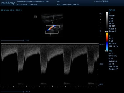 Mindray dc-8 ultrahang szkenner háromdimenziós rekonstrukció> vásárolni, az ára a moszkvai, a nagy- és