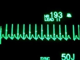 Nutriție pentru tahicardie cardiacă - tratament cardiac