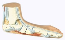 Picioarele plate longitudinale și transversale ale simptomelor de gradul III, tratamentul și stadiile bolii