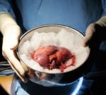 Cancerul uterin după intervenția chirurgicală, răspunsurile medicilor, consultații