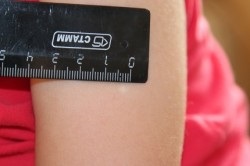 Răspuns la vaccinarea nou-născuților din tuberculoză