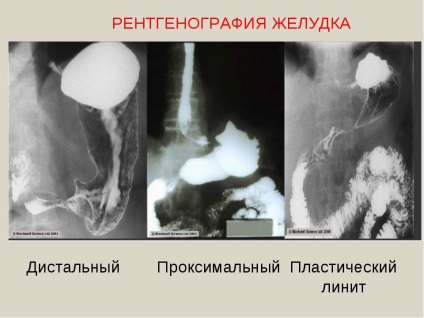 Radiografia stomacului cum se prepară