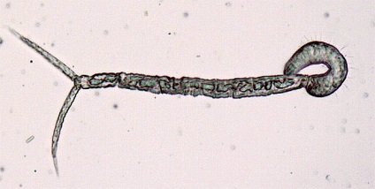 Sanguinicolosis hal, a fertőzés forrása, etiológiájú sanguinicolosis inkubációs idő, a tünetek,