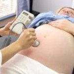 A harmadik ultrahang terhesség alatt, a harmadik rutin ultrahangvizsgálat, ha így a harmadik Uzi, hogy milyen idő igények