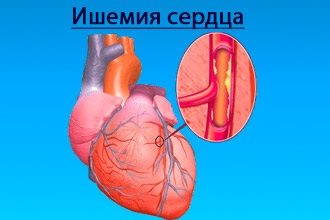 Creșterea cauzei inimii ventriculare stângi și tratamentul, consecințe