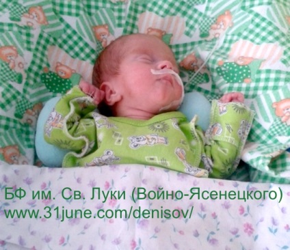 E plecat! )) jaroslav denisov, 2 luni, hidrocefalie - 31 iunie