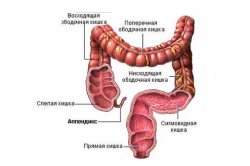 Constipație după intervenția chirurgicală la nivelul rectului