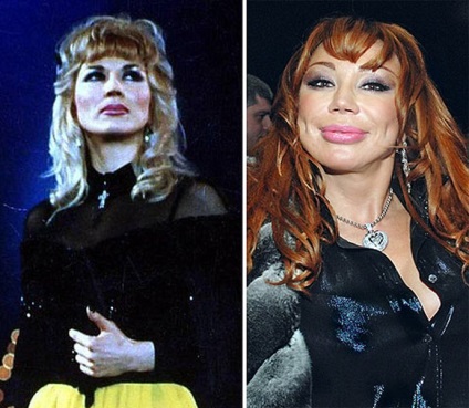 Áldozatai Plastic Surgery, Ljudmila Markovna Gurcsenko, fénykép 4