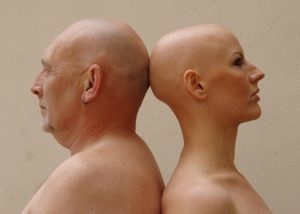 Semne de alopecie, clasificare pe specii