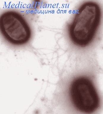 Diagnosticarea și detectarea salmonelei la copii