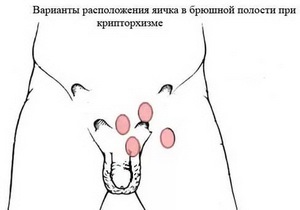 Gonadotropină corionică - pentru funcționarea normală a instrucțiunilor privind sistemul reproductiv masculin,