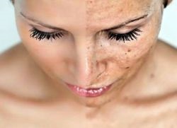 Cum să ușurați pielea feței