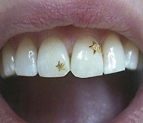 Cristalizarea dinților - unghii și extensii de păr