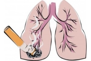 Dohányzás krónikus bronchitisszel