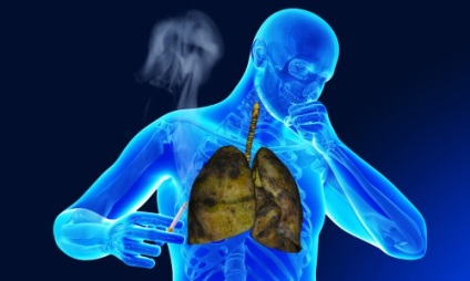Fumatul cu bronșită cronică