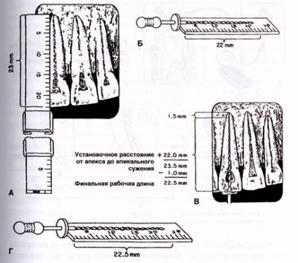 Meghatározására szolgáló módszerek üzemi hossza a gyökérkezelés - studopediya