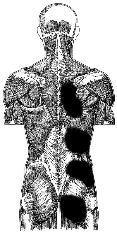 Musculare, îndreptarea coloanei vertebrale