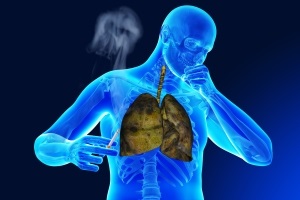 Fumatul cu bronșită cronică și acută poate afecta efectele nicotinei, consecințele