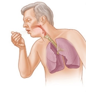 Fumatul cu bronșită cronică și acută poate afecta efectele nicotinei, consecințele