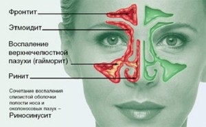 Simptome și tratament simptom frontal