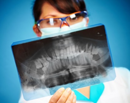 Vizualizarea panoramică a raze X a indicatorilor maxilarului (dinți), comportament, rezultate