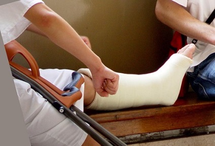 Fractura simptomelor picioarelor, tratamentul și calendarul recuperării - vii sănătoși