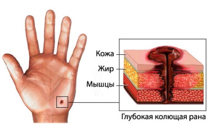 Cuts - prezentare generală - portal medical eurolab